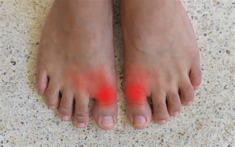 Common Causes of Big Toe Joint Pain - The Foot Clinic | Cottesloe