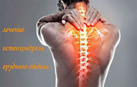 Лечение остеохондроза грудного отдела: методы терапии