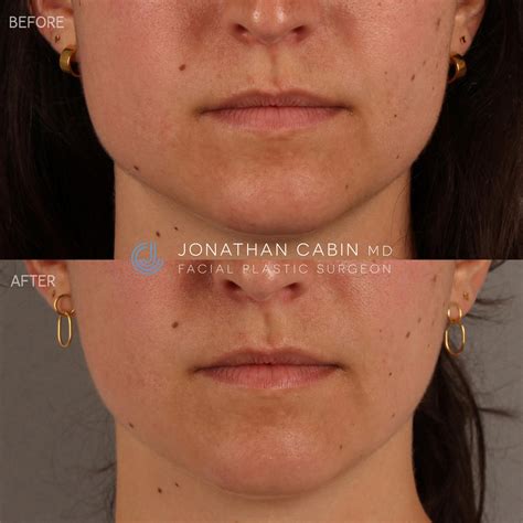 Wearing braids with bangs has a surprising face slimming effect 20