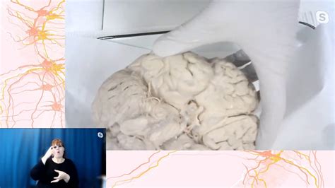 evening  neuroscience human brain dissection youtube