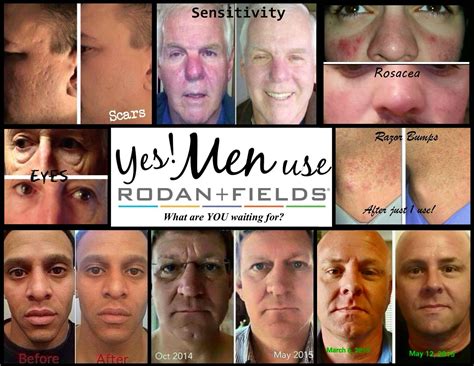 rodan & fields men's line 2