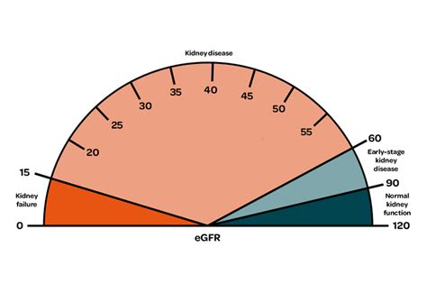 Stages of chronic kidney disease (CKD) | Kidney Care UK
