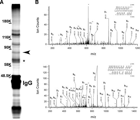 ADAM22, A Kv1 Channel-Interacting Protein, Recruits Membrane-Associated