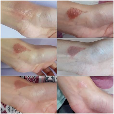 What are some home remedies for chemical burns? - Quora