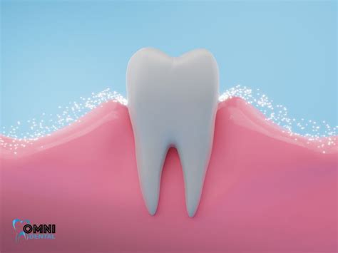 prevent gum pain tips  healthy gums omni dental