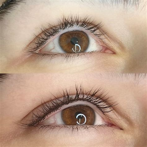 Permanent Eyeliner Before And After Pictures