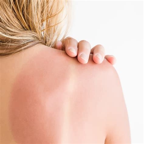 chronic stress symptoms   remedies dr axe