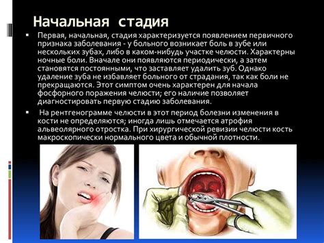 Интоксикация фосфором и его соединениями - презентация онлайн