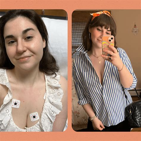 Endometriosis Symptoms, Causes & Treatments | SELF
