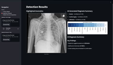 AI in Chest X-Rays: Using DenseNet-121 for Enhanced Diagnosis - Tech4Biz