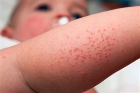 Pakalpojumi RU — Skin
