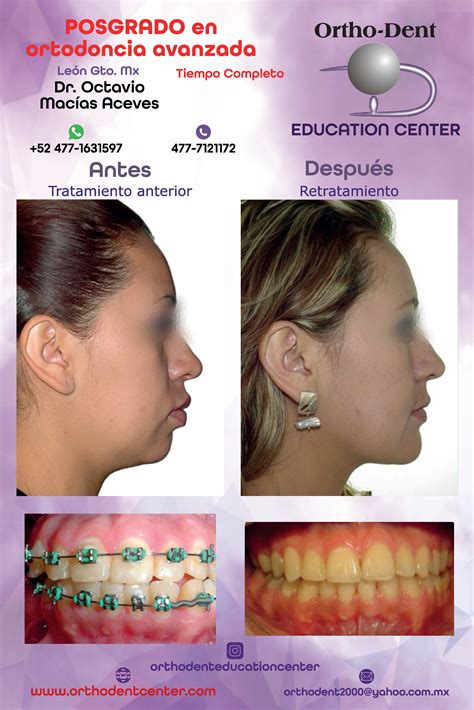 Casos de Éxito - Ortho-Dent Education Center