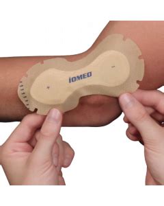 Iontophoresis | Performance Health