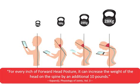 posture   physiomed