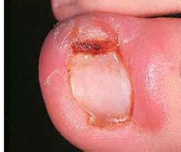 DR: HUMBERTO SILVA - ESMALTES