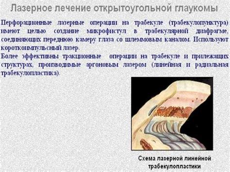 Глаукома. Внутриглазное давление - презентация онлайн