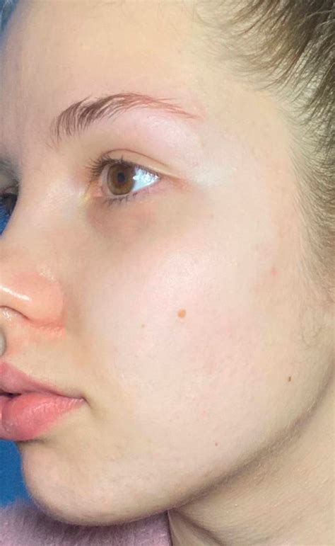 Эффективный пилинг Viselle DTX PEEL 33% по доступной цене! | Косметиста