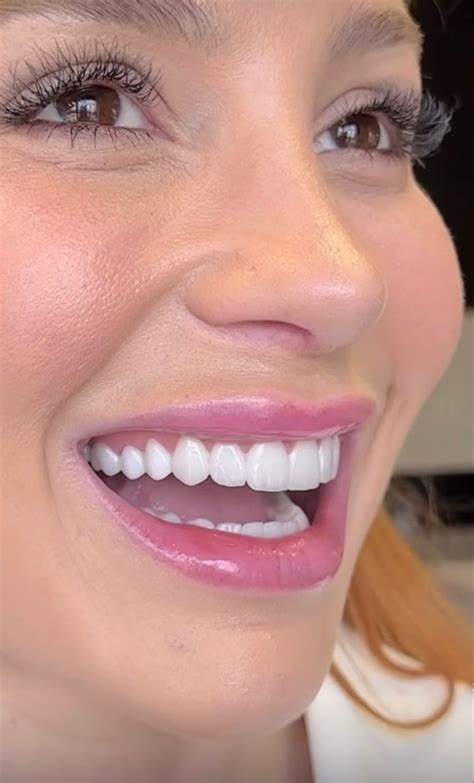 Pin af Shantel på Teeth i 2024