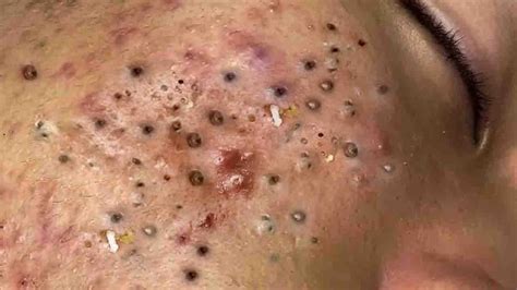 Perfect Time From LN Skincare # - YouTube