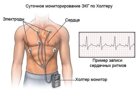 Холтеровское мониторирование в Москве – цены на мониторинг сердечного ...