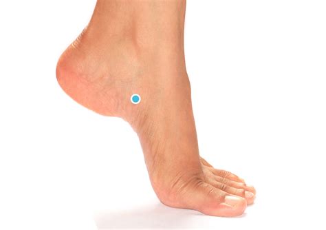 os tibiale externum voetchirurgie