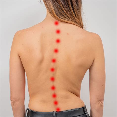 6 powerful natural remedies for spinal stenosis – Artofit