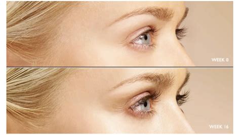 Latisse Eyelash Growth | Longer, Fuller Lashes in Weeks