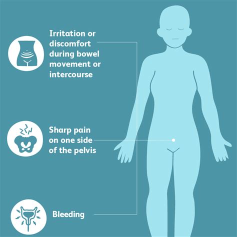 Ruptured Ovarian Cysts: Diagnosis, Treatment, and More