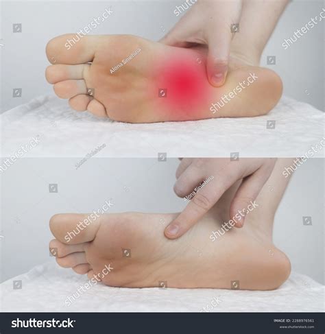 Before After Sole Foot Pain Tendon Stock Photo 2288976561 | Shutterstock