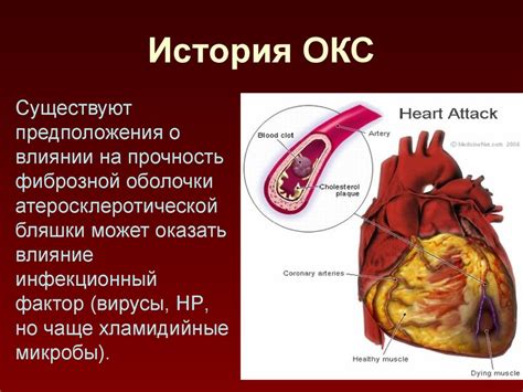 Острый коронарный синдром - презентация онлайн