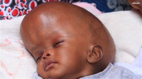 Baby Boy Big Forehead at Ken Escobar blog