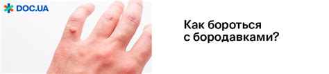 Как убрать бородавку, способы вывести, удалить бородавку в домашних ...