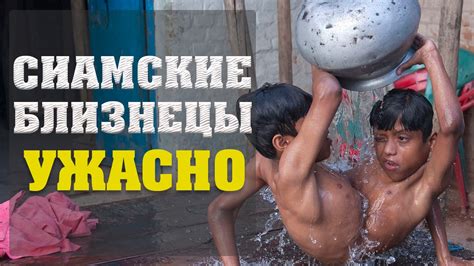 ТОП10 СИАМСКИЕ БЛИЗНЕЦЫ - YouTube