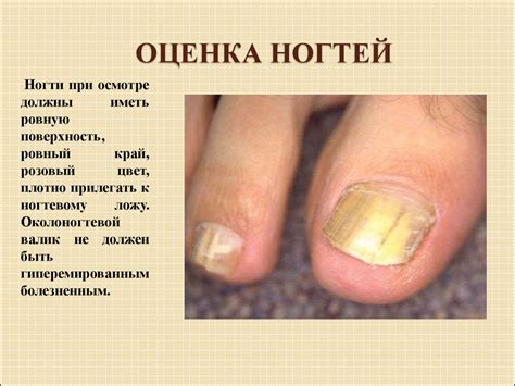 Методика Обследования Пищеварительной Системы У Детей Презентация ...