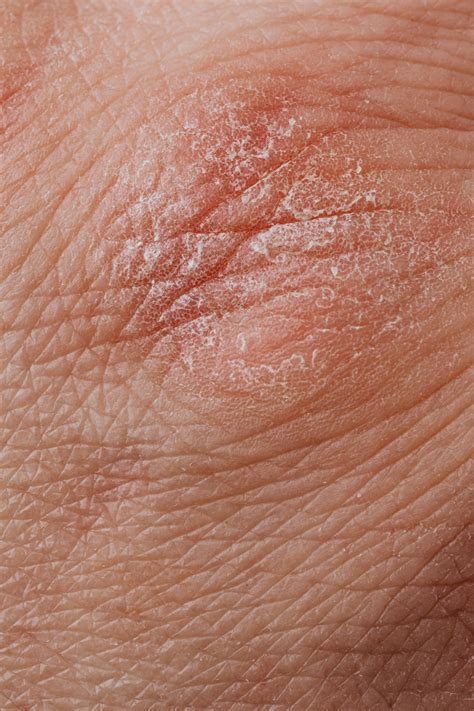 Knight Dermatology