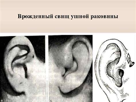 ИЗБРАННЫЕ ВОПРОСЫ АНАТОМИИ И ФИЗИОЛОГИИ СЛУХОВОГО АНАЛИЗАТОРА ЗАБОЛЕВАНИЯ