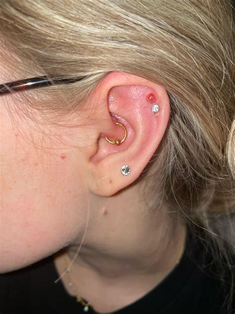 Infected ear piercings : r/piercing