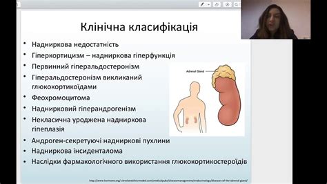 Захворювання надниркових залоз - YouTube
