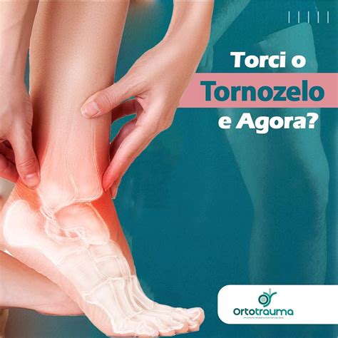 Torci O Tornozelo O Que Fazer - Torci o tornozelo, e agora? - Ortotrauma