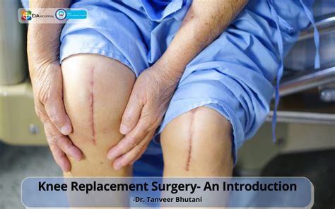 Total Knee Replacement- Recovery Timeline - Eva Hospital