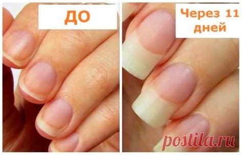 3 доступных ингредиента, которые ускоряют рост ногтей в два раза ...
