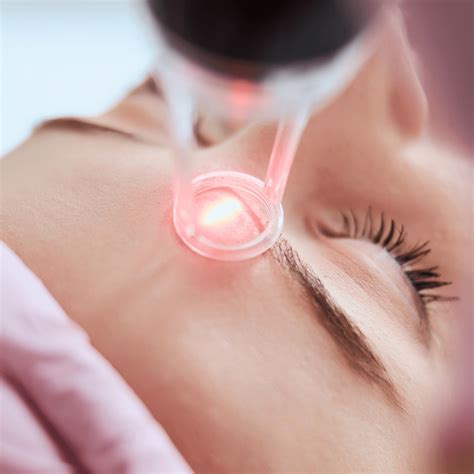 Laser Lavieen Para Que Serve 5