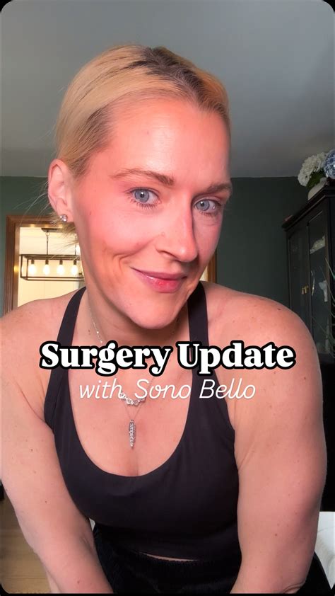 sonobello before and after 2