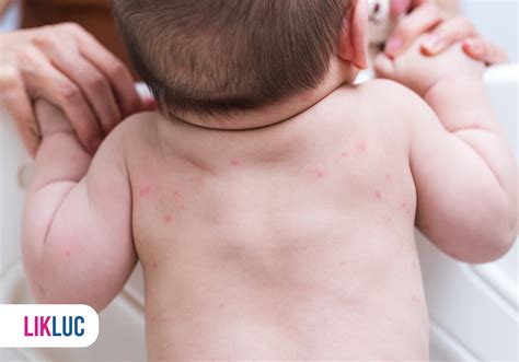 Roséola Em Bebê E Perigoso - Roséola infantil: o que é, causas, tratamentos e mais