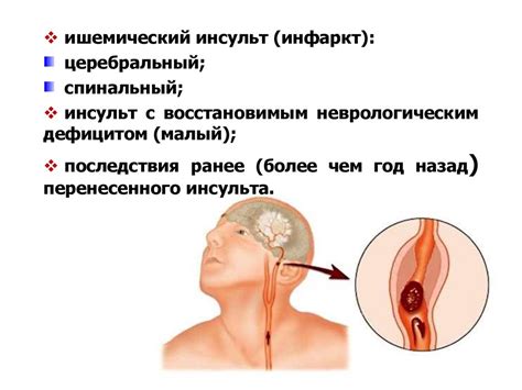 Цереброваскулярные заболевания - презентация онлайн