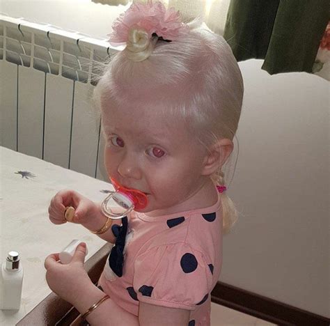 Пин на доске ALBINO people
