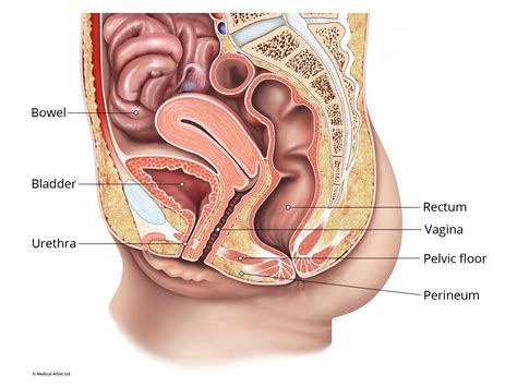 Stage 1 Bladder Prolapse