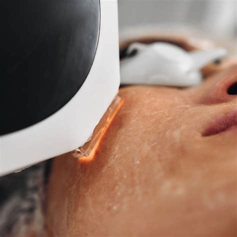 discover  benefits  laser treatments