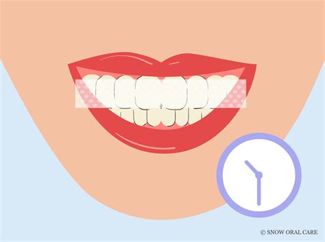 How Long to Leave Whitening Strips On for Best Results?