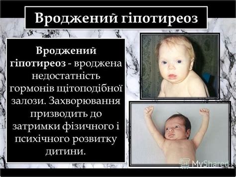 Презентация на тему: "Скринінг новонароджених". Скачать бесплатно и без ...